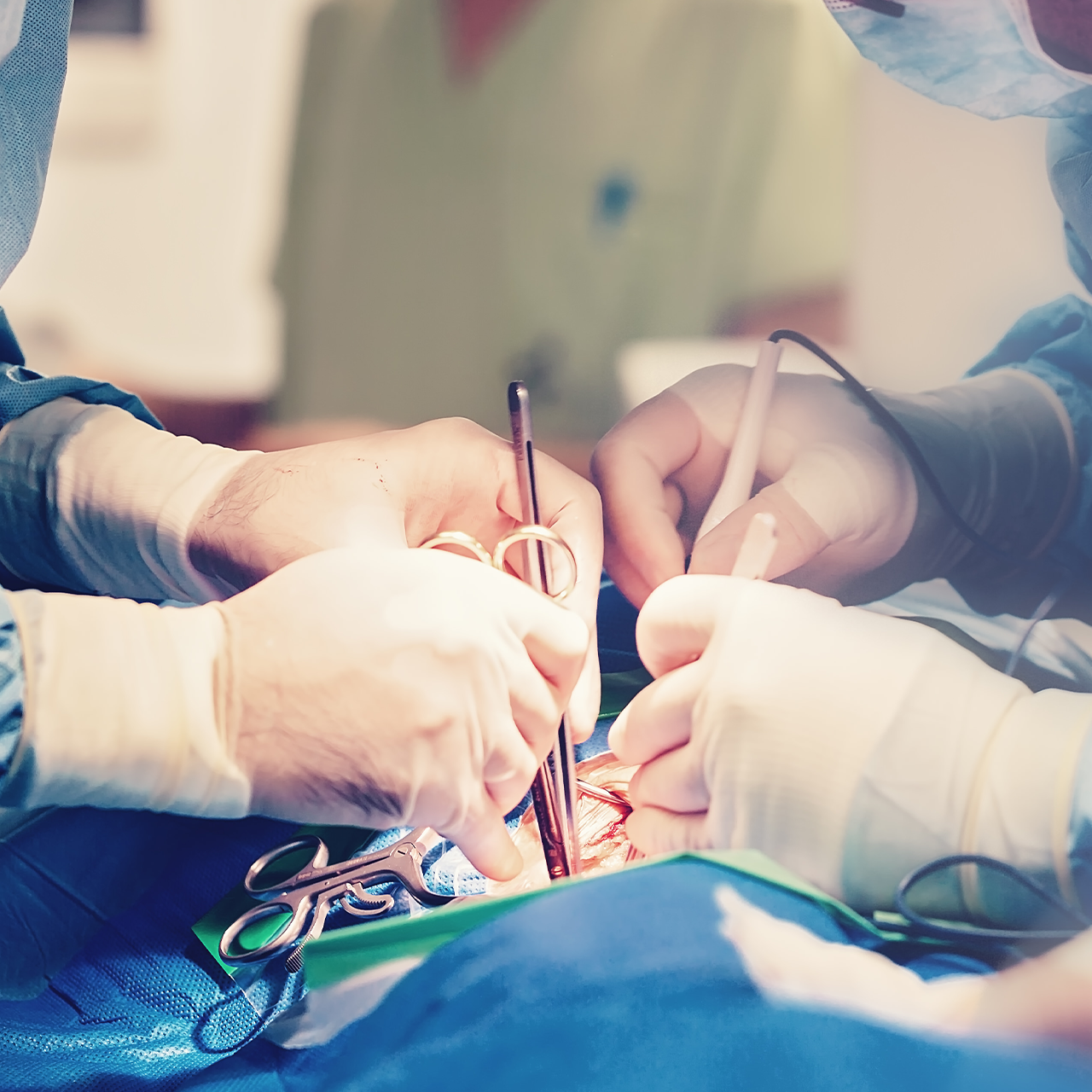 Medical professionals performing a heart procedure.