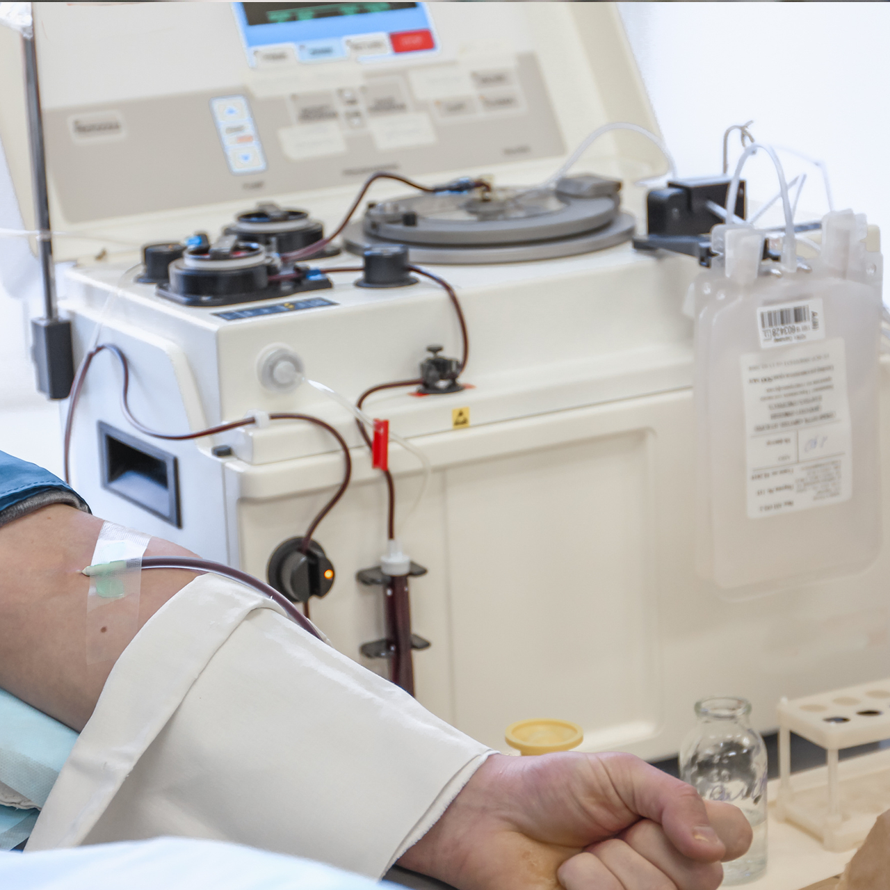 IV tubing extracting blood from a patient's arm