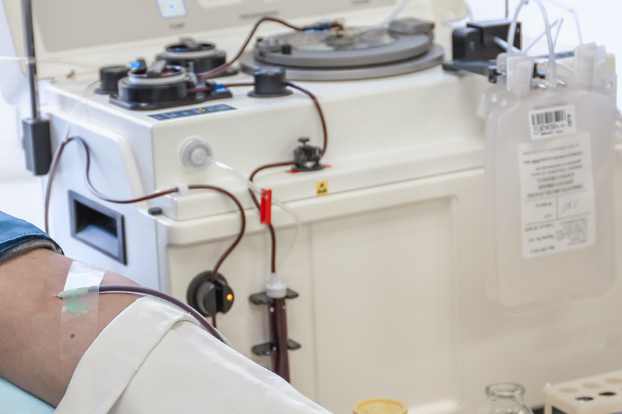 IV tubing extracting blood from a patient's arm