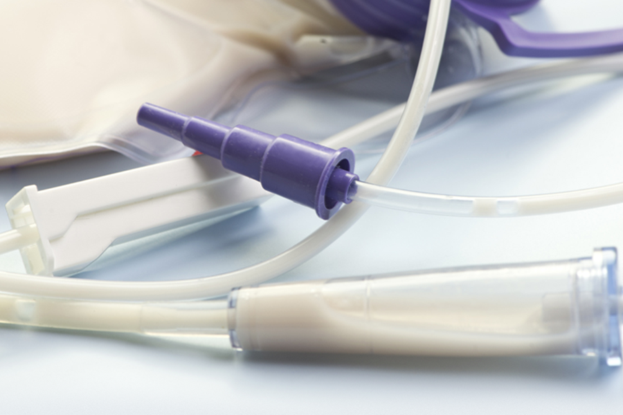 Enteral feeding catheter solutions by SPG